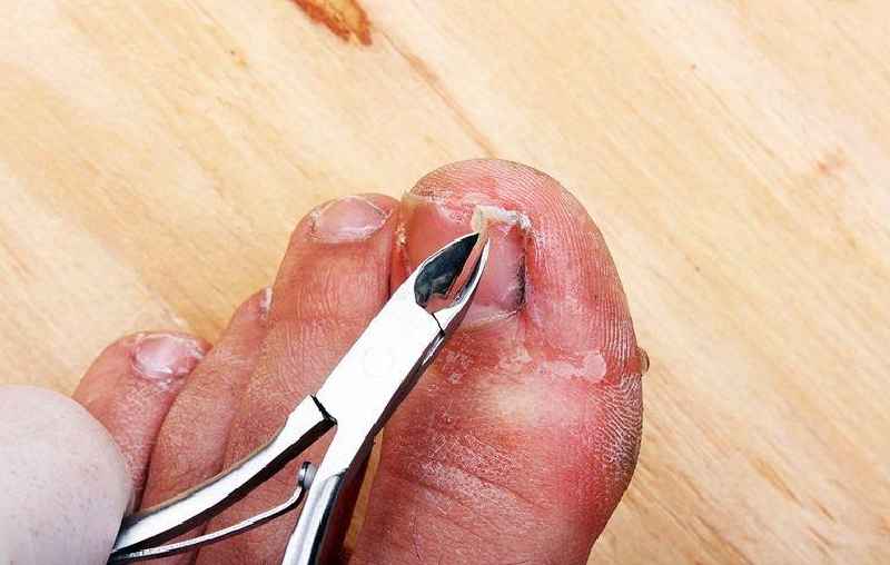 How do you cut thick yellow toenails