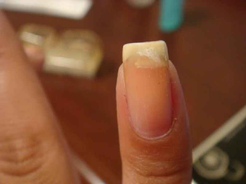 How do you fix a broken nail with toilet paper