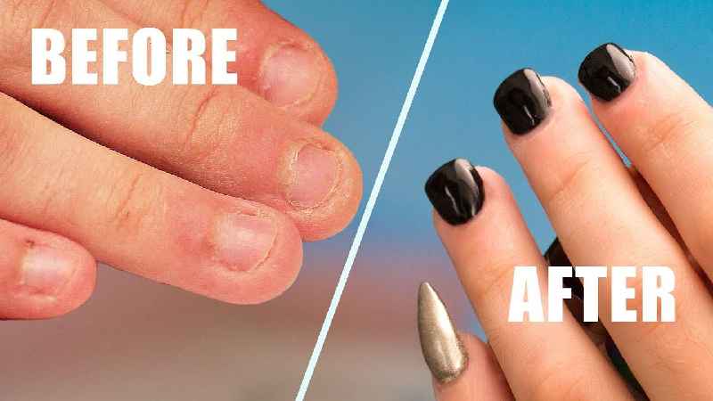 How do you fix traumatized nails