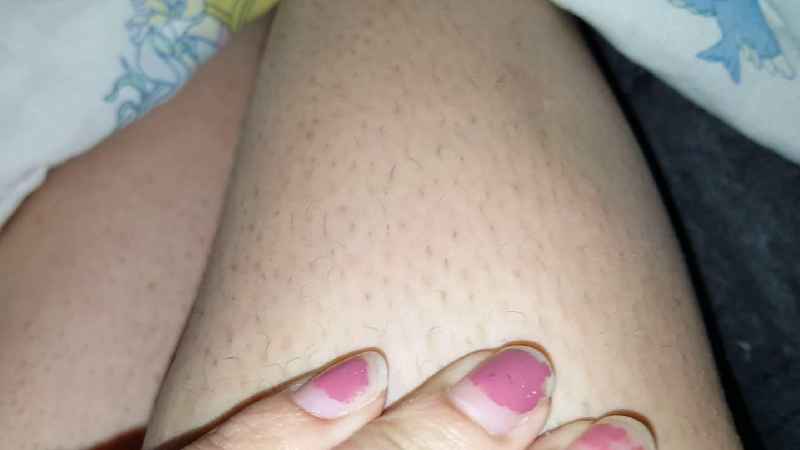 How do you get rid of hairy legs without shaving or waxing