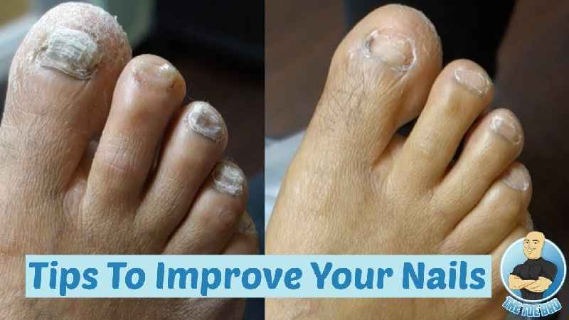 How do you grind thick toenails