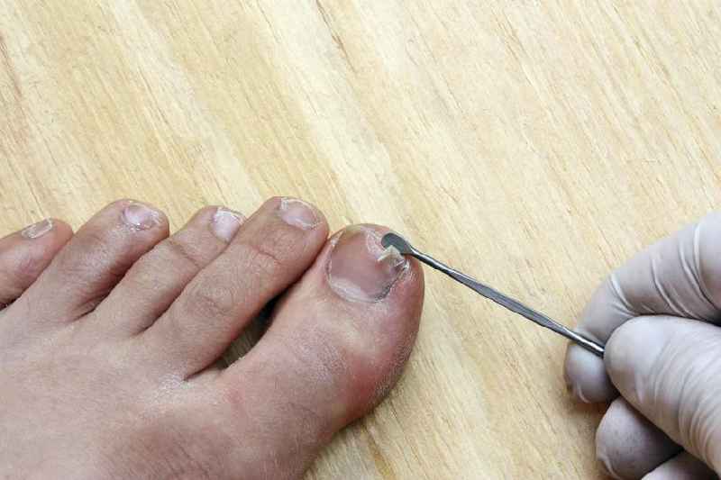 How do you heal a split nail down the middle