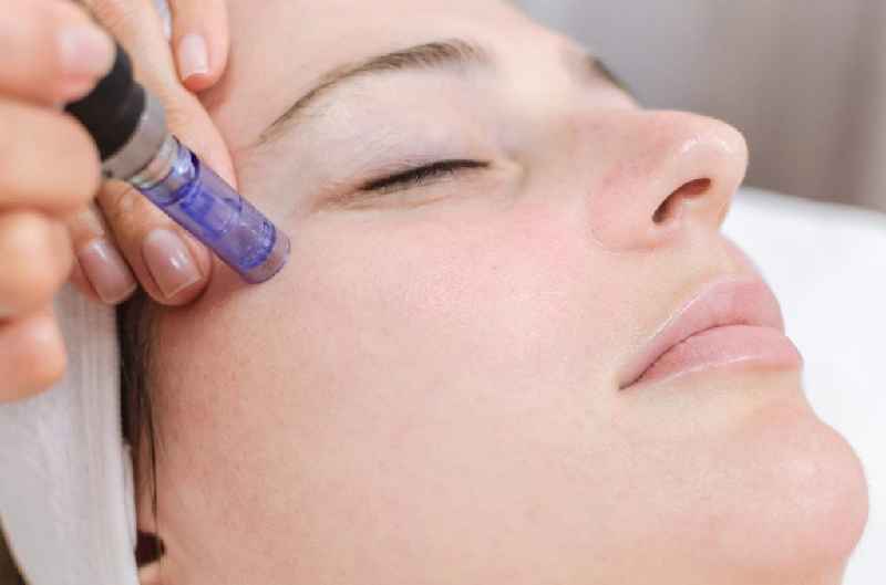 How do you know if Microneedling is working