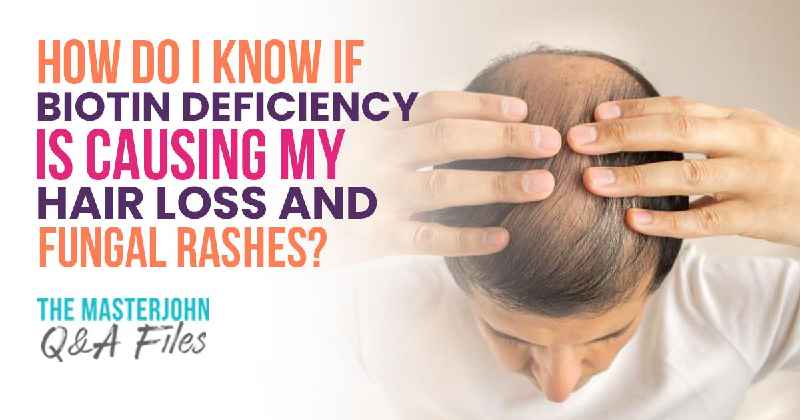 How do you know what is causing hair loss