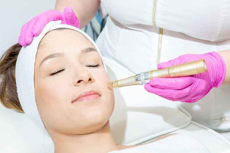 How do you maximize Microneedling results
