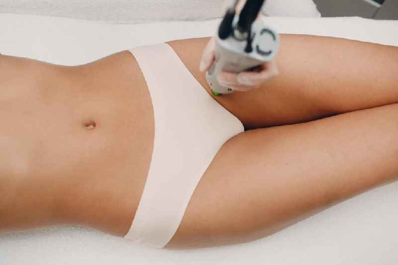 How do you prepare for full body laser hair removal