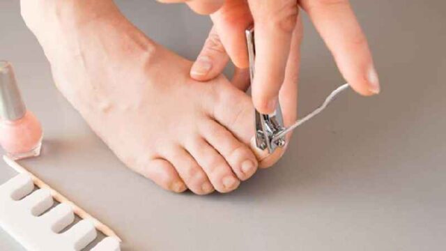 How To Care For Toe After Nail Falls Off