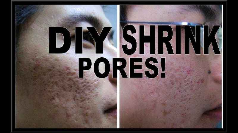 How do you unclog pores