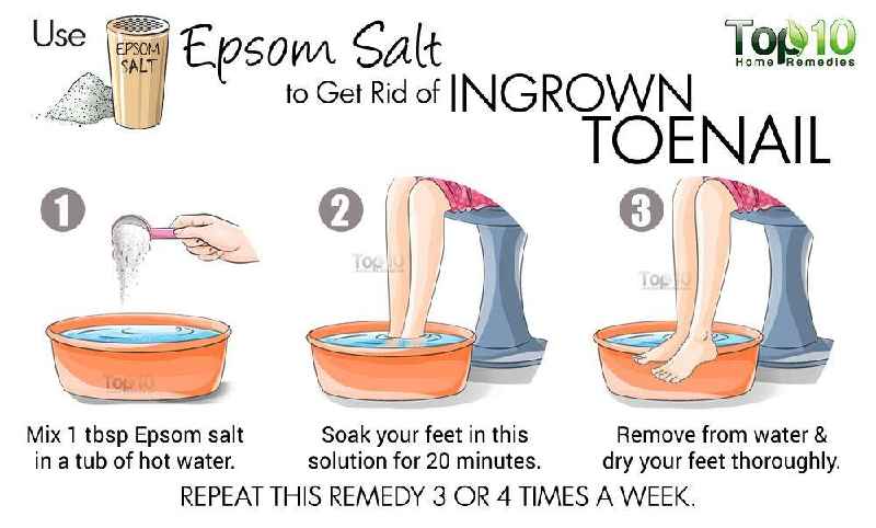How does Epsom salt help an ingrown toenail
