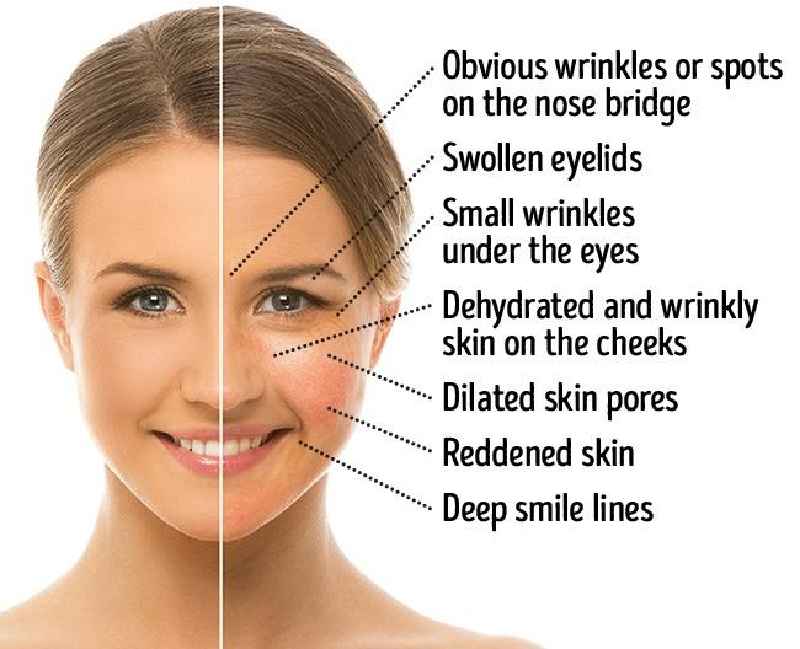 How does MSM affect skin