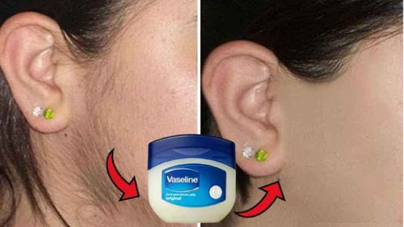 How does Vaseline remove unwanted hair