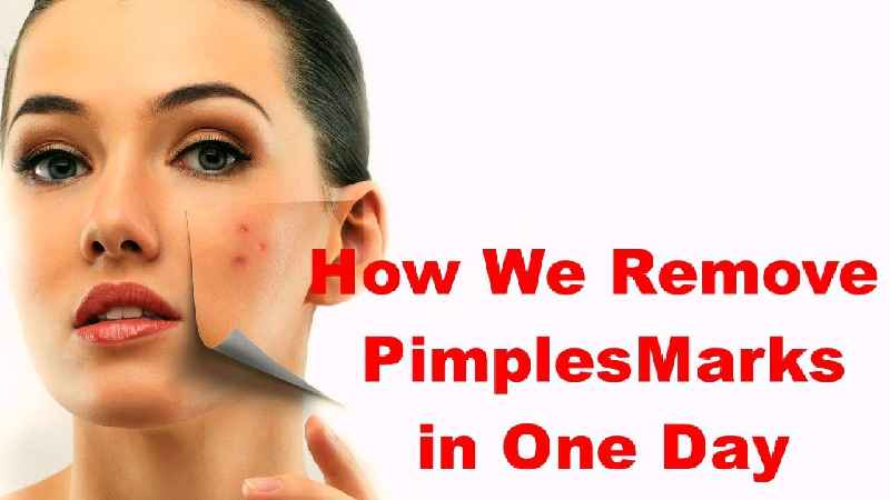 How I remove my pimples