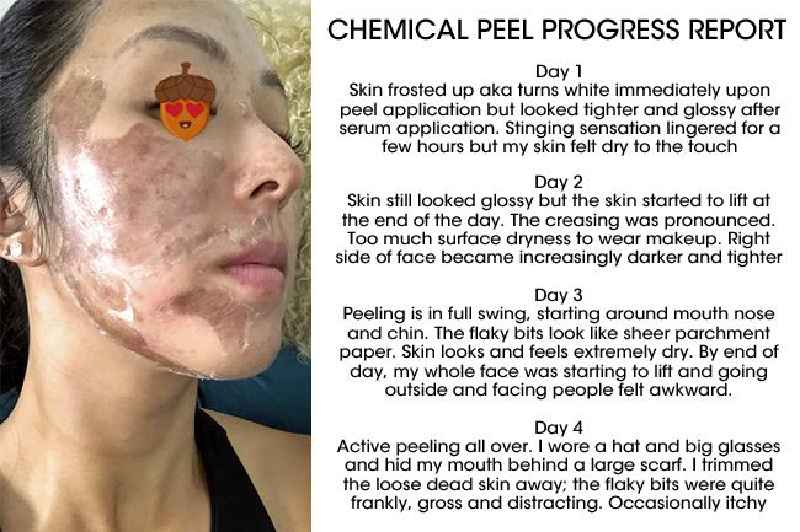 How long after chemical peel can you wear makeup