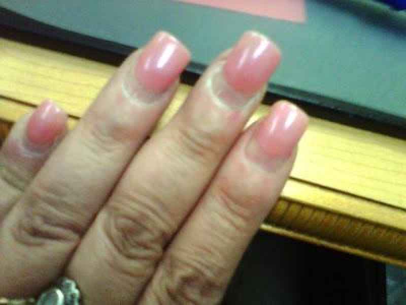 How long do damaged nails take to heal