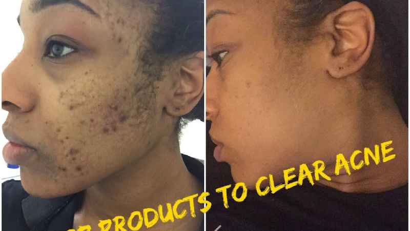 How long does it take facial scars to heal