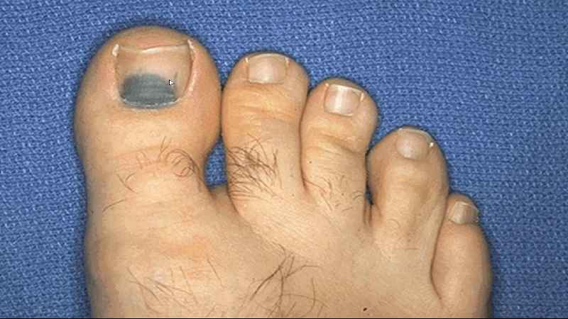 How long does it take for a big toe nail to grow back