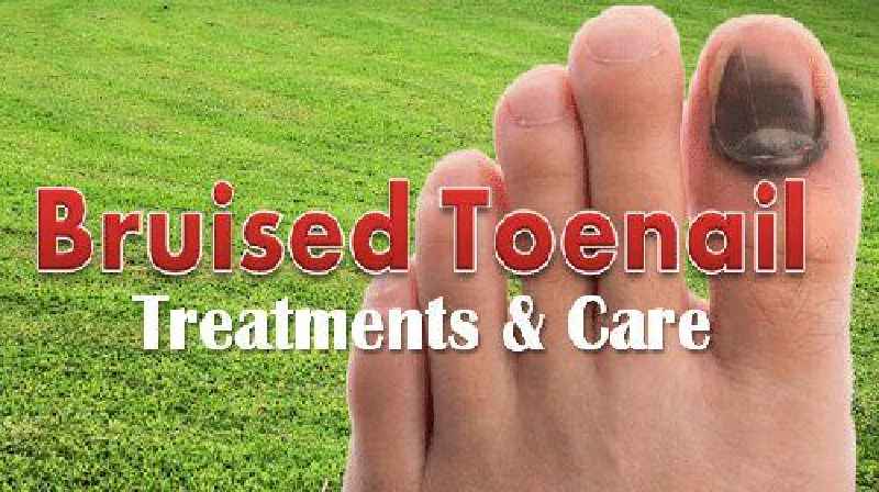 How long does it take for a cracked toenail to heal