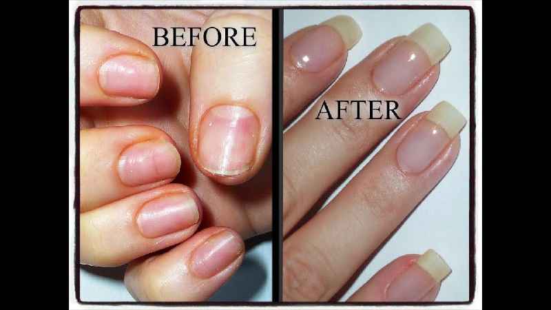 How long does it take for damaged nails to grow out