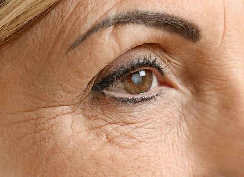 How long does it take to recover from eye bag surgery