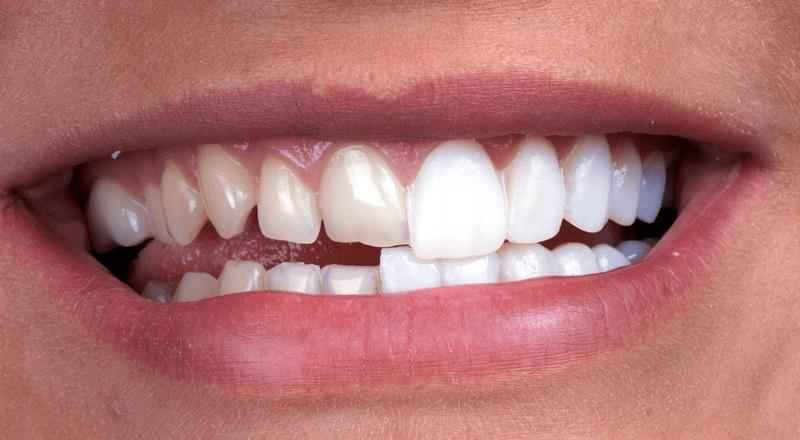 How long does it take to study cosmetic dentistry