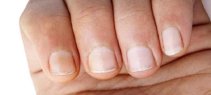 How long should I leave Vaseline on my nails