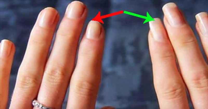 How long should you soak a residents nails