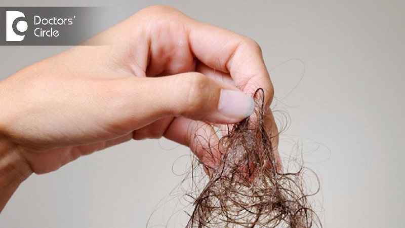 How long will hair shedding last
