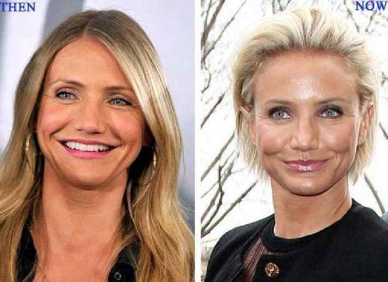 How many cosmetic surgeries go wrong