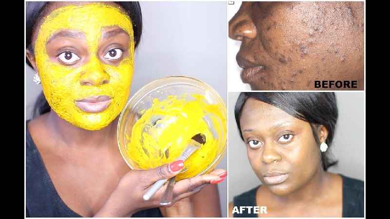 How many days does turmeric take to remove dark spots