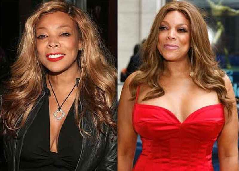 How many face surgeries has Wendy Williams had