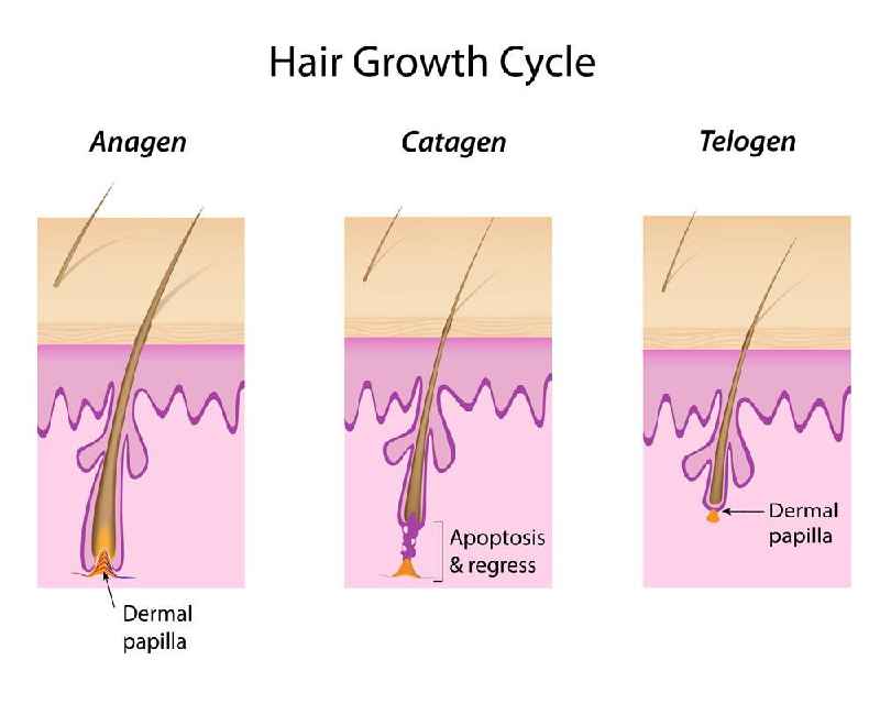 How many hairs can electrolysis remove
