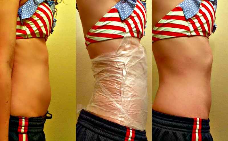 How many inches can Lipo Remove from waist