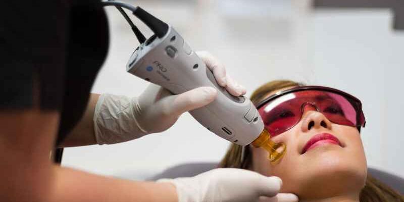 How many laser hair removal treatments are needed for face