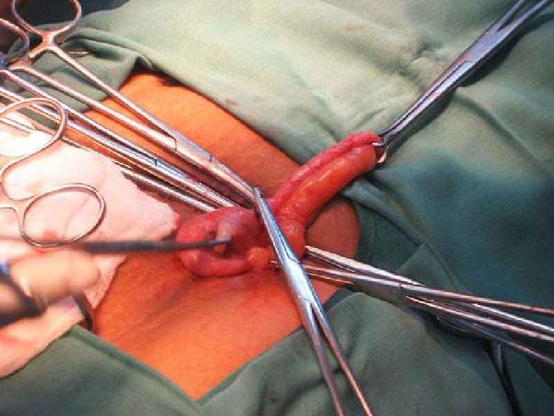 How many surgical procedures are performed each year in the US
