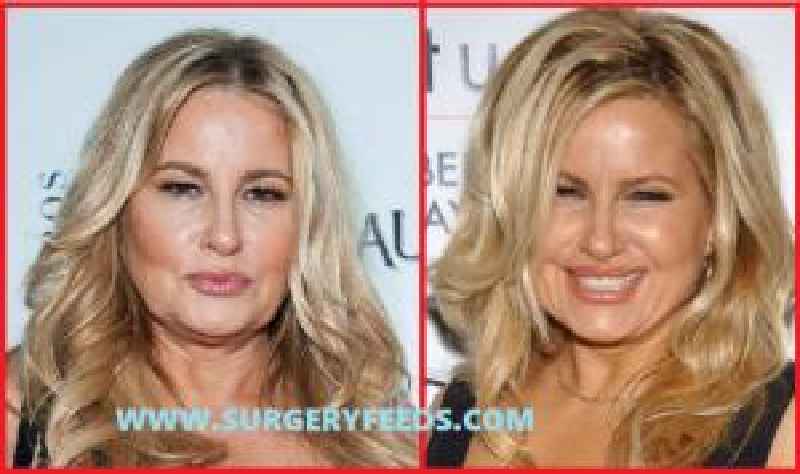 How many types of cosmetic surgeries are there