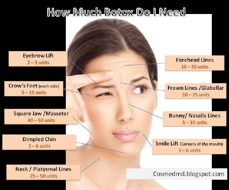 How many units of Xeomin is equivalent to Botox