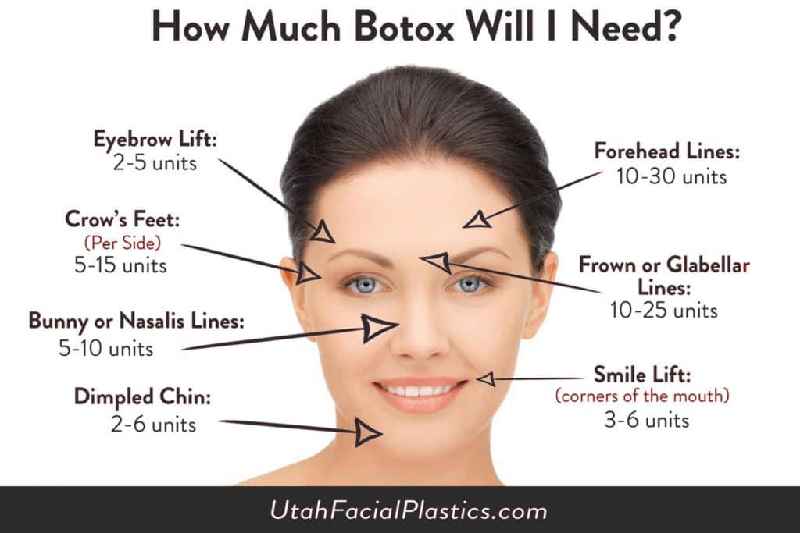 How much does Botox cost for forehead