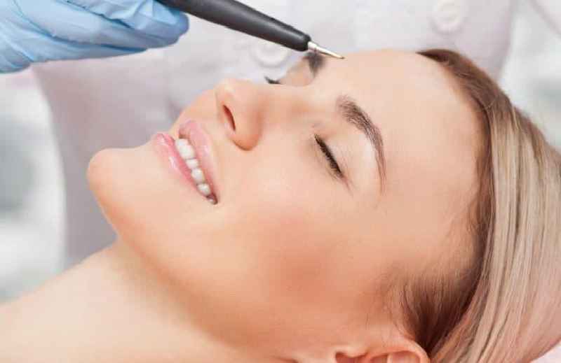How much does electrolysis hair growth cost
