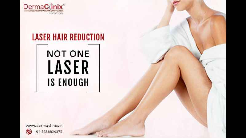 How much does full face laser hair removal cost in India