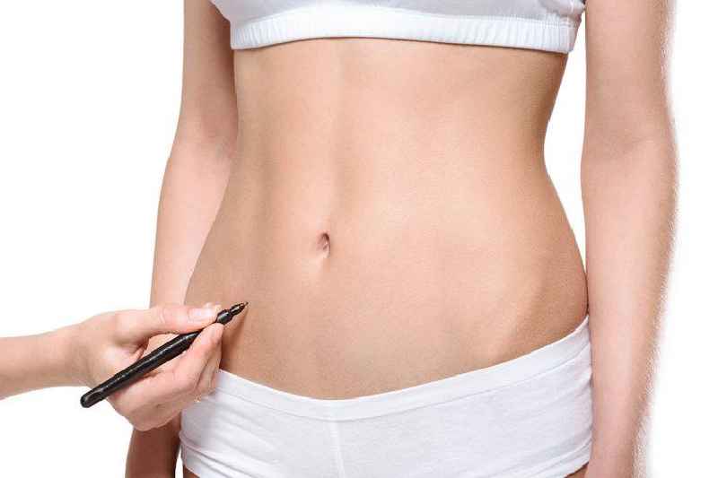 How much does it cost to remove belly pooch