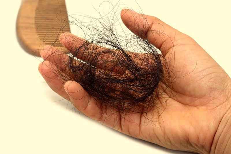 How much hair loss after pregnancy is too much