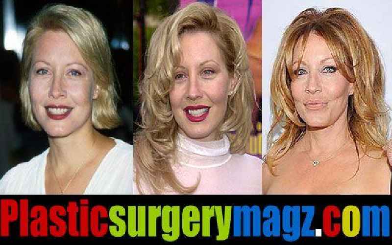 How much is the cosmetic surgery industry worth 2021