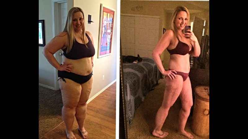 How much weight do you lose in 3 months after gastric sleeve