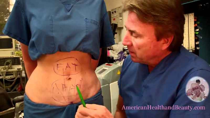 How painful is a tummy tuck