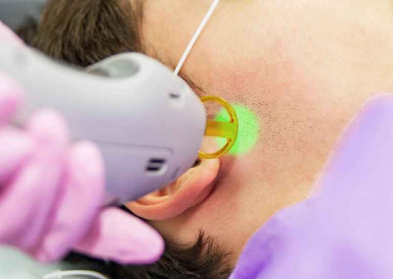How painful is hair laser removal