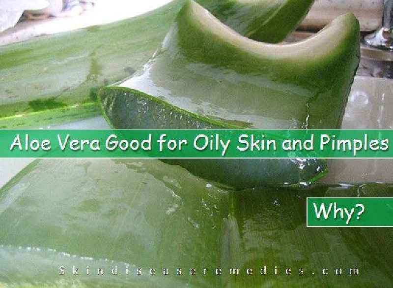 Is Aloe Vera good for dry skin