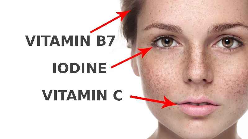 Is biotin the same as B12