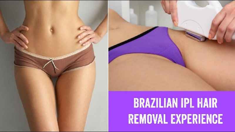 Is Brazilian laser hair removal embarrassing