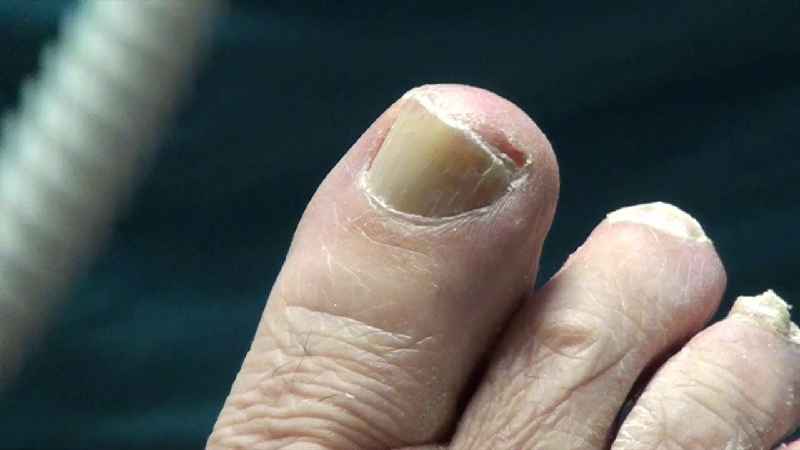 Is cutting your nails good for you