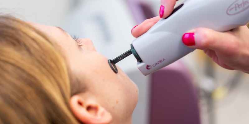 Is hair laser treatment safe